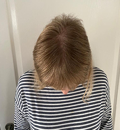 Pharma Hermetic Ampoules