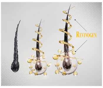 Revivogen MD 90 -Day Hair Regrowth Scalp Therapy Kit