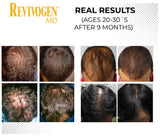 Revivogen MD 90 -Day Hair Regrowth Scalp Therapy Kit