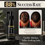 Revivogen MD 90 -Day Hair Regrowth Scalp Therapy Kit