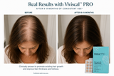 Viviscal Professional 180ct