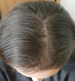 Pharma Hermetic Ampoules