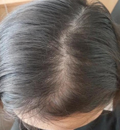 Pharma Hermetic Ampoules