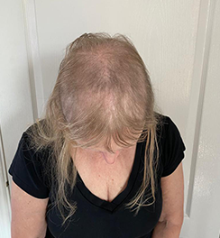 Pharma Hermetic Ampoules